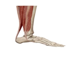 Ρήξη Αχιλλείου Τένοντα