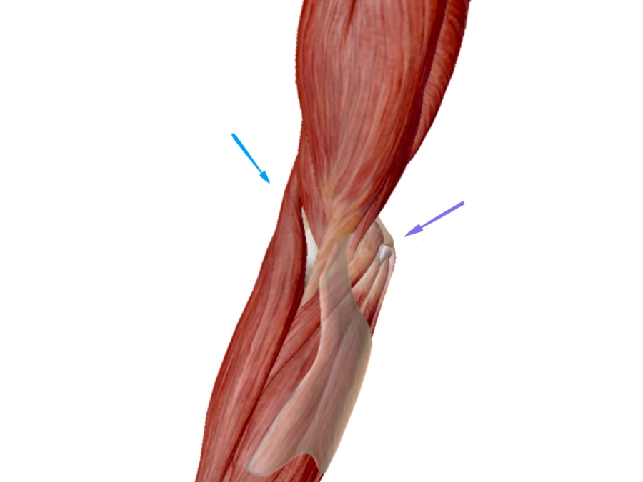 Επικονδυλίτιδα του Αγκώνα